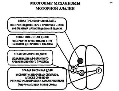 Механизмы моторной алалии